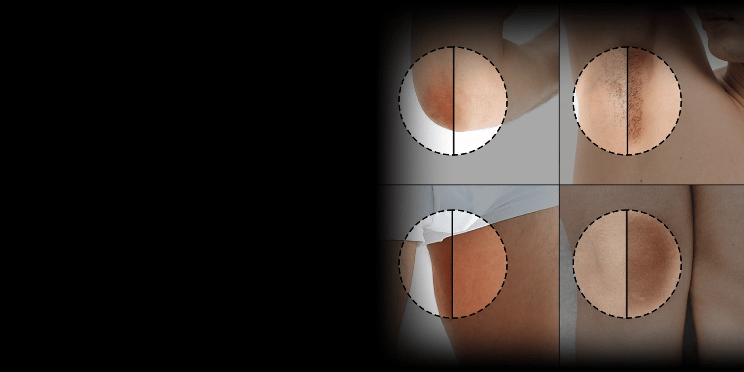 Illuminate Sensitive Areas