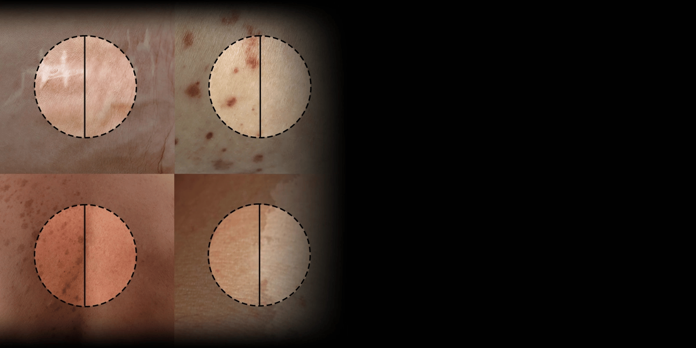 Safeguard Skin from Future Issues