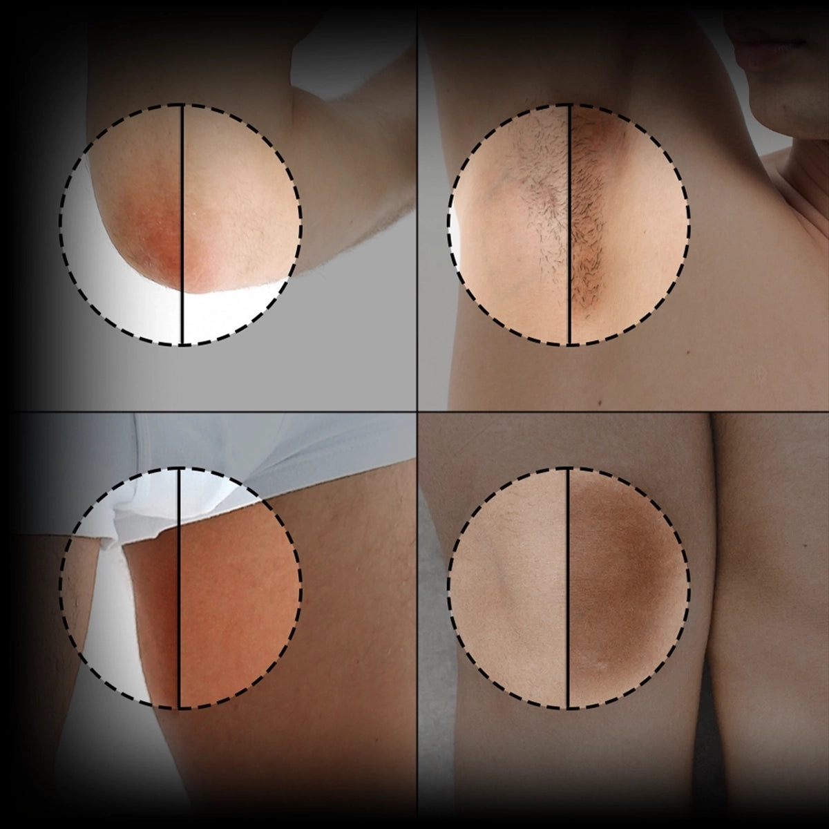Illuminate Sensitive Areas