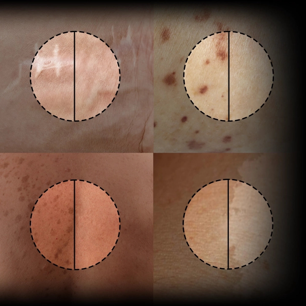 Safeguard Skin from Future Issues