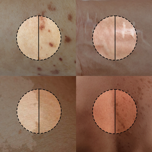 Menhood® Dark Spot Serum