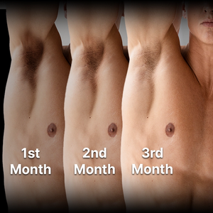 Menhood® Dark Spot Serum